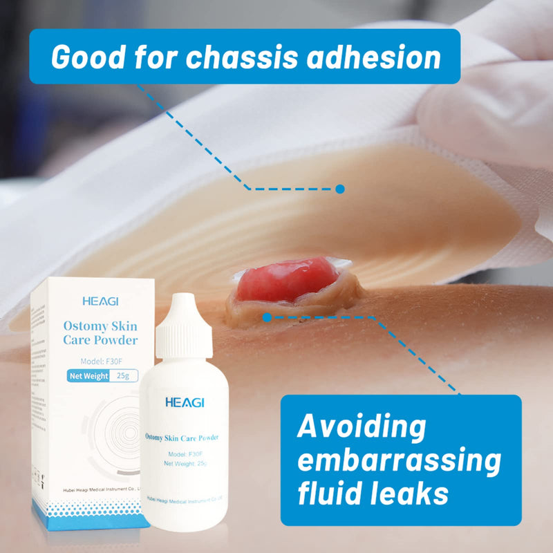 [Australia] - Heagied Stoma Powder, Skin Barrier Protection Ostomy Powder Supplies, Stoma Adhesive Powder, Ostomy Skin Care Powder, Ostomy Supplies(25g) 