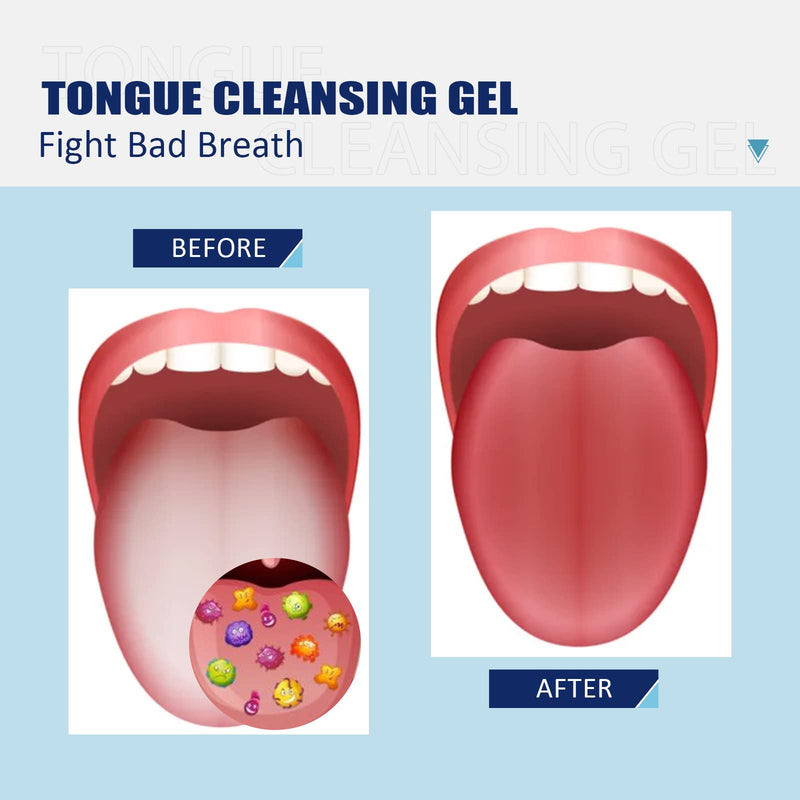 [Australia] - Tongue Cleaning Gel Set, Tongue Cleaner Gel with Tongue Brush, Easy to Use for Adults Kids, Tongue Scraper Scrubber for Adults with Cleaning Gel 