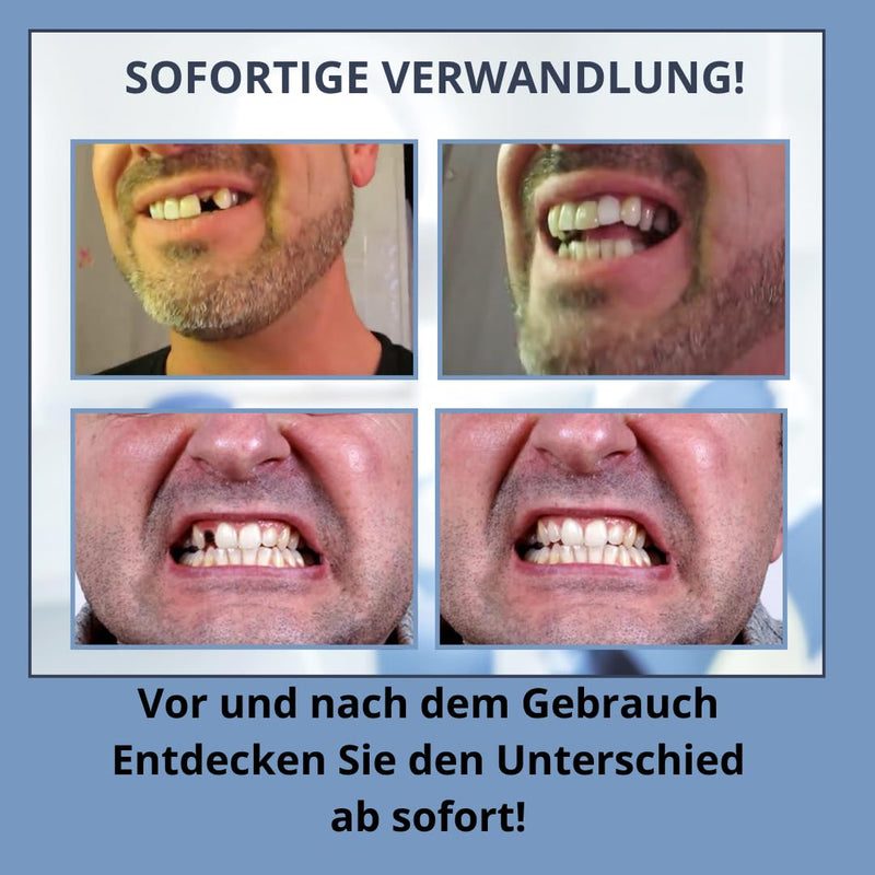 [Australia] - DENTIMED temporary dentures for clipping on - Temporary dentures for clipping on - Tooth repair set for temporary tooth prostheses - Artificial & false teeth for clipping on - cosmetic tooth 