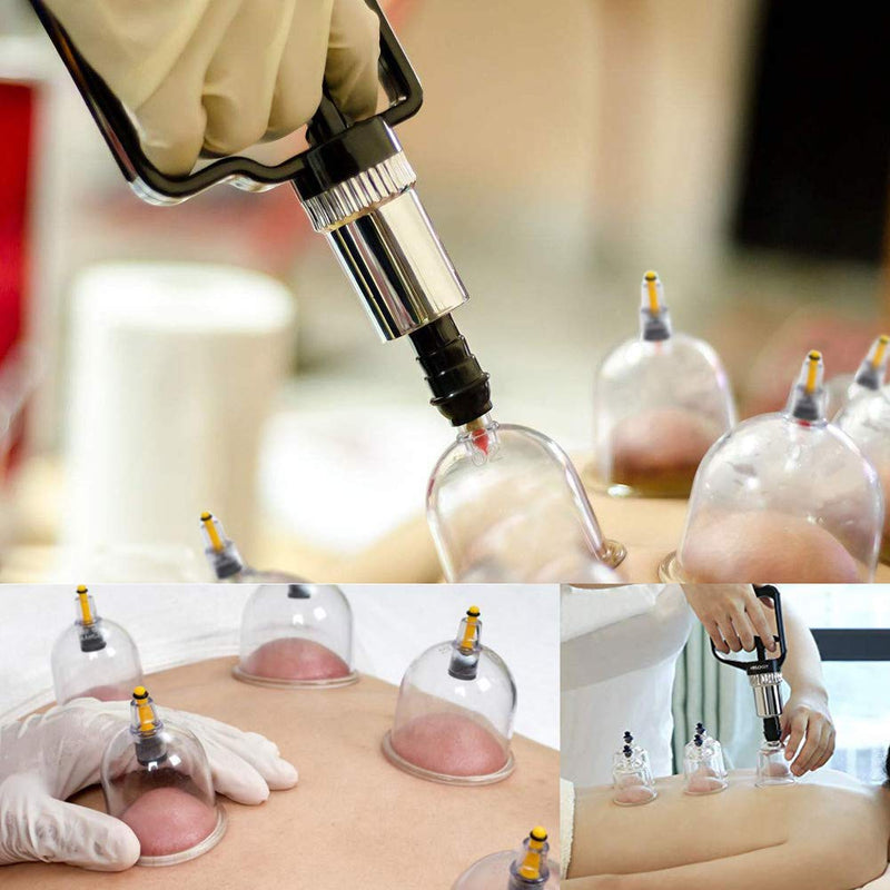 [Australia] - Cupping Set Professional Chinese Acupoint Cupping Therapy Sets Portable, Suction Hijama Cupping Set with Vacuum Magnetic Pump Cellulite Cupping Massage Kit 22-Cup 