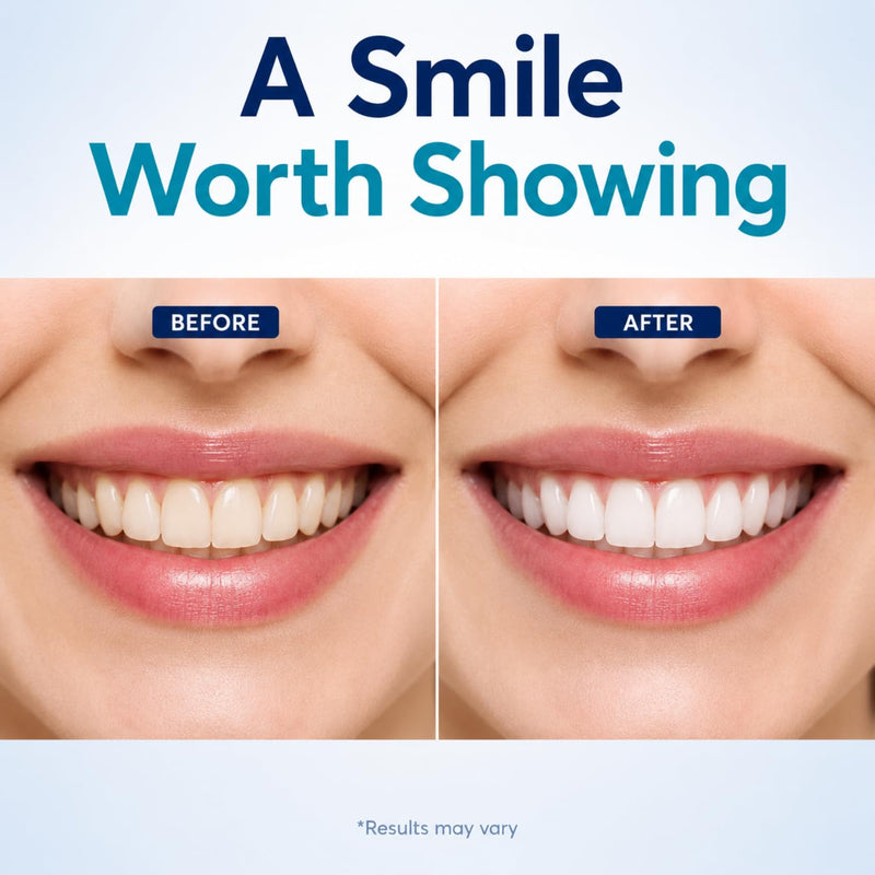 Prefilled Teeth Whitening Trays for a Brighter Smile – 7-Day At-Home Whitening Kit with 14 Disposable Mint Trays for Adults, Easy No-Mess 30-Minute Daily Use for Noticeably Whiter Teeth 7-Day Treatment