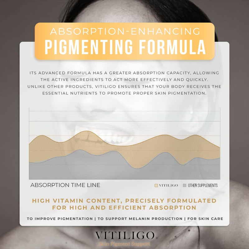 Dermawonder Vitiligo Capsules 60 Count | Effective Vitiligo Supplement | Reduce White Spots and Improve Skin Pigmentation Support | Suitable for All Skin | Natural Solution for White Spots on (3) 3