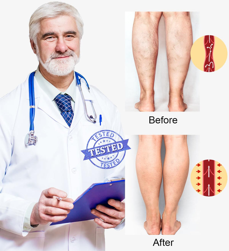 [Australia] - 2 pairs of calf medical compression stockings for women and men, 20-30 mmHg, class 2, calf support, graduated support, support stockings for varicose veins, edema, flight sports, 3XL, black and beige 