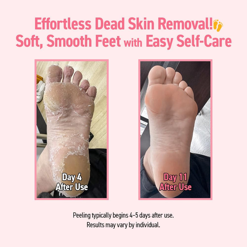 [Australia] - Silky Smooth Foot Peeling Mask – Exfoliating Booties for Soft Feet, Callus & Dead Skin Remover, Easy At-Home Pedicure (2 Pairs / 4 Pairs) (4 Pairs (Pack of 1)) 4 Count (Pack of 1) 