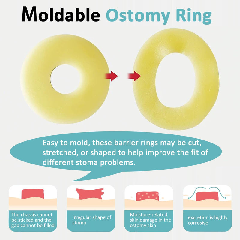 [Australia] - 20PCS Ostomy Barrier Rings, Medical Hydrocolloid Ostomy Supplies, Moldable Ostomy Ring, Leak-Free Skin Extender Rings, Stoma Protector Seal for Colostomy Bags 
