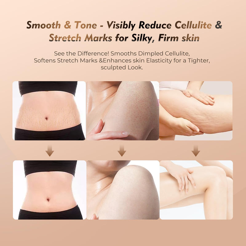 35-Speed 3-in-1 Microcurrent Lymphatic Drainage Massager for Legs Arms Belly, Body Sculpting Machine with Microcurrent, Cellulite Massage Tool,Light, Heat |Vibration, Promotes Circulation Skin Renewal