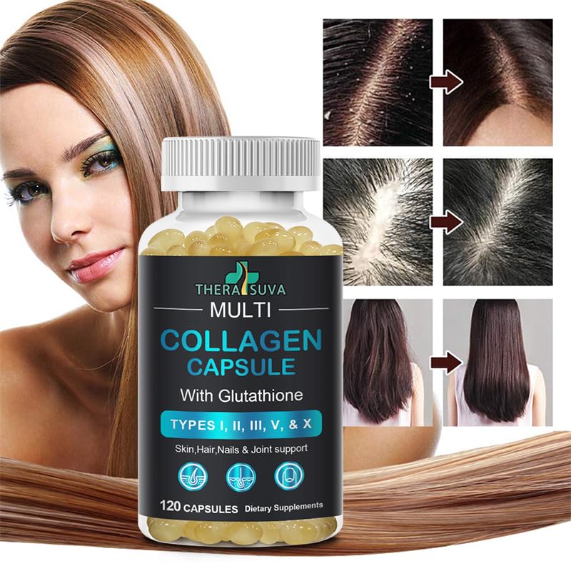 TheraSuva Complete Multi Collagen Complex – Types I, II, III, V & X + Biotin & Vitamin C – Hair, Skin, Nails & Mobility Support, 2 Month Supply, 120 Softgels