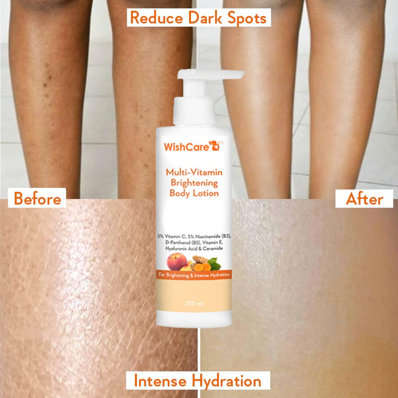 WishCare Multi-Vitamin Brightening Body Lotion for Men & Women, 200ml | 5% Vit C, Niacinamide, Panthenol & Vit E; Turmeric & Kakadu Plum; 5 non-comedogenic moisturizers; fragrance-free & vegan