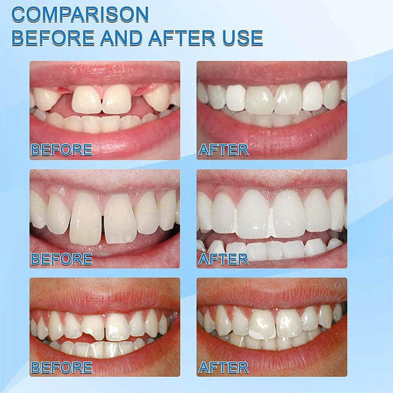 [Australia] - Dental Repair Denture Repair Beads,Tweezers,Dental Pick,Dental Tools for Fixing Filling Missing Broken Tooth Moldable Fake Teeth 1pcs 