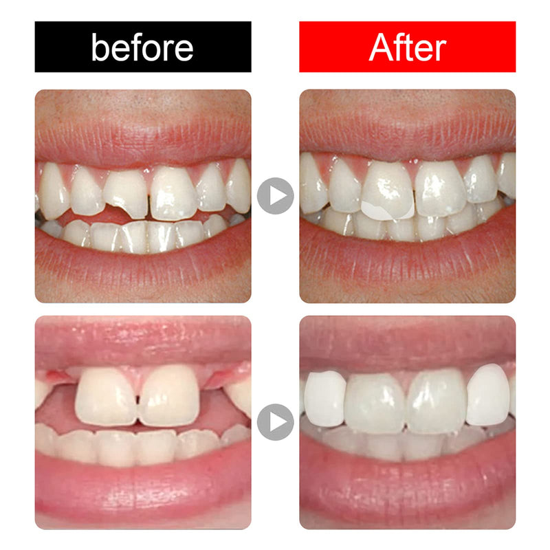 [Australia] - 168 Pieces False Teeth Dental Complete Acrylic Resin Denture Teeth, 6 Sets Whole Teeth Synthetic Polymer Denture Tooth, 23 Shade A3 Upper + Lower Dental Materials for Replacement, DIY, or Halloween 