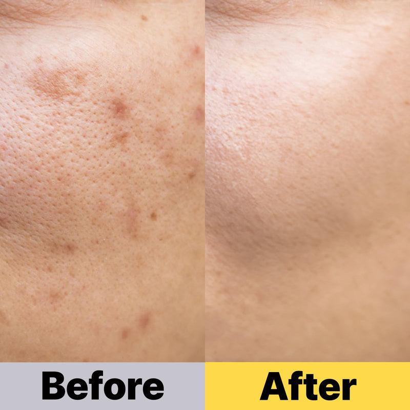 COSNOLOGY K-Beauty Ampoule: Niacinamide + Vitamin C, E & Glutathione for Dark Spots & Even Skin Tone | Hydrating & Anti-Aging Skin Serum, 2.7fl.oz(80ml)