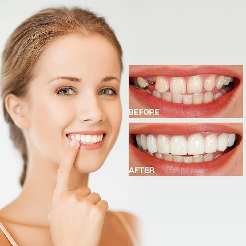 [Australia] - Prostheses Fake Teeth, 5 Pairs False Artificial Teeth Braces Smile Veneers Cosmetic Temporary Teeth Dentures Prosthesis Artificial Veneers Teeth Top and Bottom 