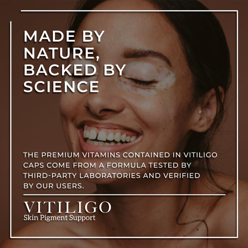 Dermawonder Vitiligo Capsules 60 Count | Effective Vitiligo Supplement | Reduce White Spots and Improve Skin Pigmentation Support | Suitable for All Skin | Natural Solution for White Spots on (3) 3