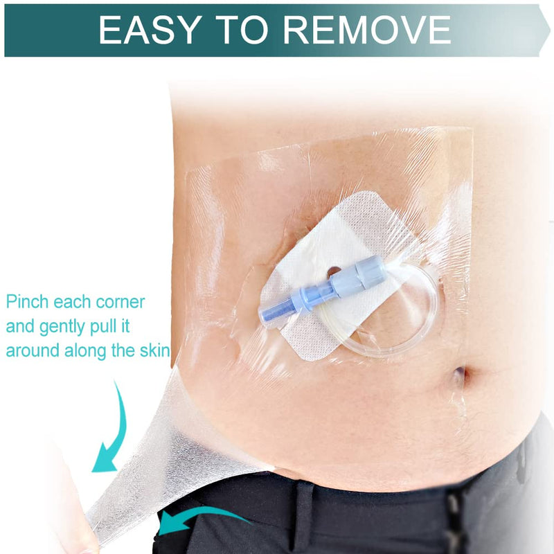 [Australia] - Waterproof Ostomy Bag Shower Cover with Non Sticky Pad Colostomy Ilostomy Urlostomy Pouch Shower Guard Shield 9x9, 25pcs Ostoma Cover(9"x9", Pack of 25) 