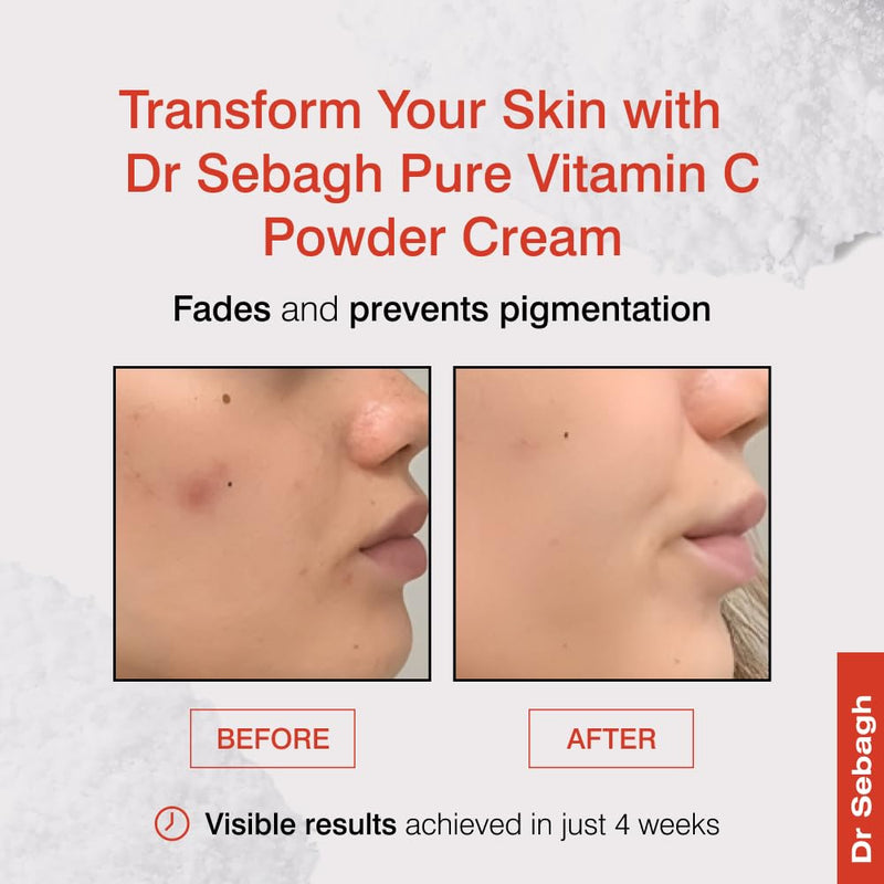 Dr Sebagh – Vitamin C Powder Cream (1.95g) Travel Size [Clinically Proven Radiance] – Vitamin C Cream for Face – Glow Boosting Skincare – Vitamin C Cream for Dark Spots, Eye, Face & Acne