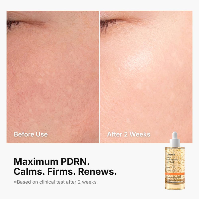 Genabelle PDRN Vitamin C Serum Toning Ampoule JUMBO SIZE - Lightweight Glass Skin,korean skin care with Vitamin B, C, E, PDRN, Serum for Blemishes, Fine Lines and Rough Skin Texture, 2.36 fl oz 2.36 Fl Oz (Pack of 1)
