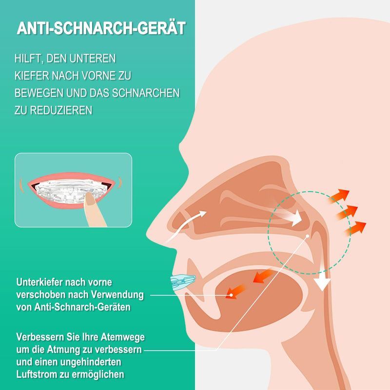 [Australia] - Anti-snoring splint, effective solutions for quiet nights and relaxed snoring, adjustable anti-snoring snoring-free stopper, snoring stopper against teeth grinding 