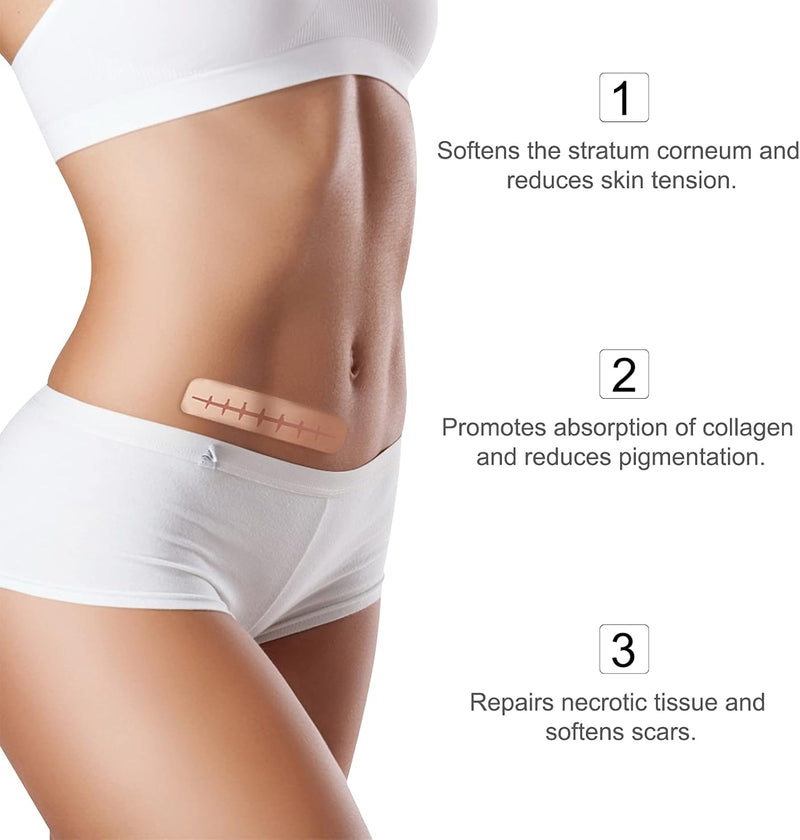 [Australia] - Silicone Scar Tape Silicone Plaster for Scars Scar Plaster Silicone Silicone Plaster for Scars (4 x 300 cm) Ultra Thin Soft and Breathable Suitable for Burns and Cesarean Section Scars 