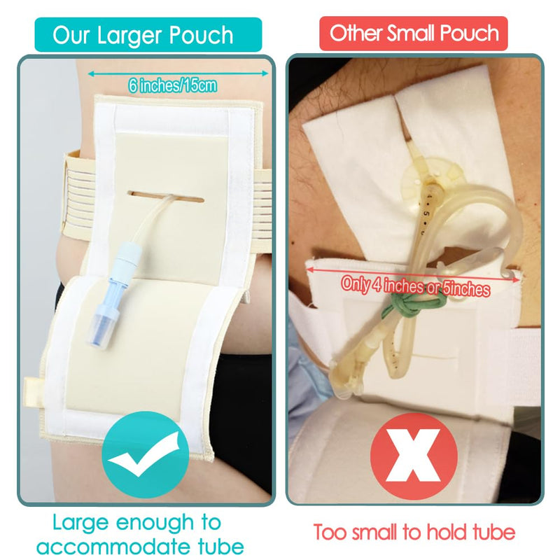 [Australia] - Breathable Feeding Tube Belt G Tubes Belts Peg Tube Belt Elastic G Tube Holder Gastrostomy Tubes Protective Supplies with 6" Square Sponge Pouch Pad Covers for Women Men Beige, Medium Medium (Pack of 1) 