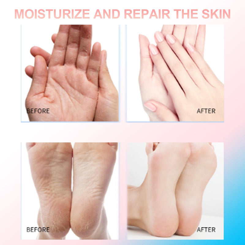 [Australia] - Crack Feet Prevention Stick, Foot Balm, Crack Heel Cream -Smooth Protective BalM, Foot Balm for Dry Cracked Feet, Refreshing, Hydrating, Deep Moisturizing (Pink+Blue, one size) Pink+Blue 1.41 Fl Oz (Pack of 1) 