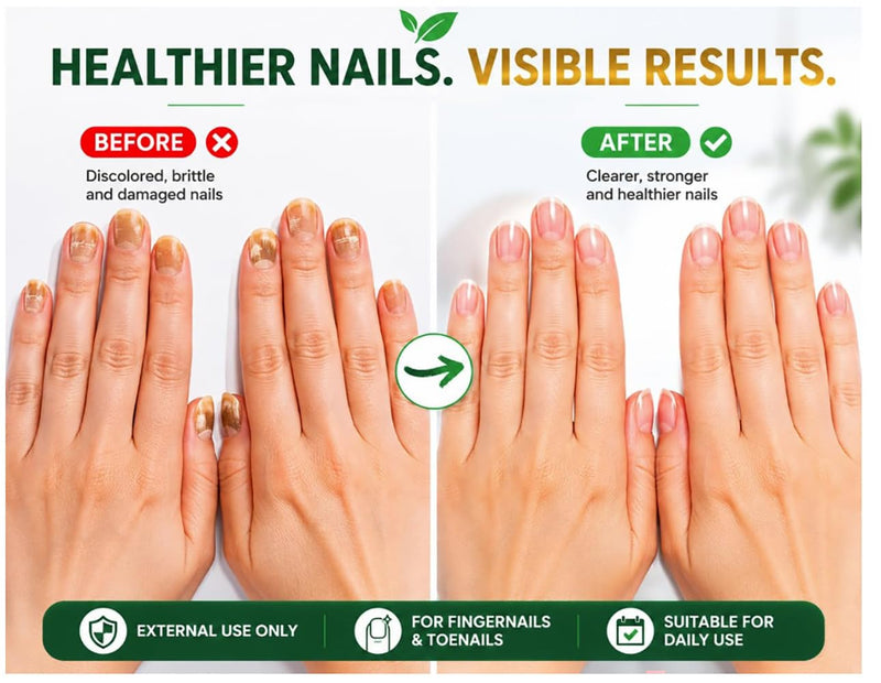 Nail Treatment | Tratamiento para uñas | 0.5oz | Made in USA (1 Pack) 1 Pack