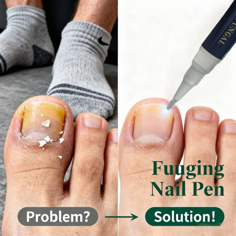 Toenail Fungi Treatment Extra Strength & Fungi Nail Pen - 4PC Fungi Nail Pen Repair for Damaged Nails,Targeted Solution for Nail Health Concerns (Athletes Ideal), 4ml/0.14FLOZ -2 Blue-3