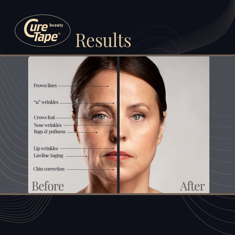 [Australia] - CureTape Beauty Kinesiology Tape | Anti-Wrinkle Face Tape | Face Lift Tape for Toning, Firming & Tightening The Skin | Kinesiology Tape for Face and Sensitive Skin | Soft on The Skin (2'' X 16') 2'' X 16' Light Beige 