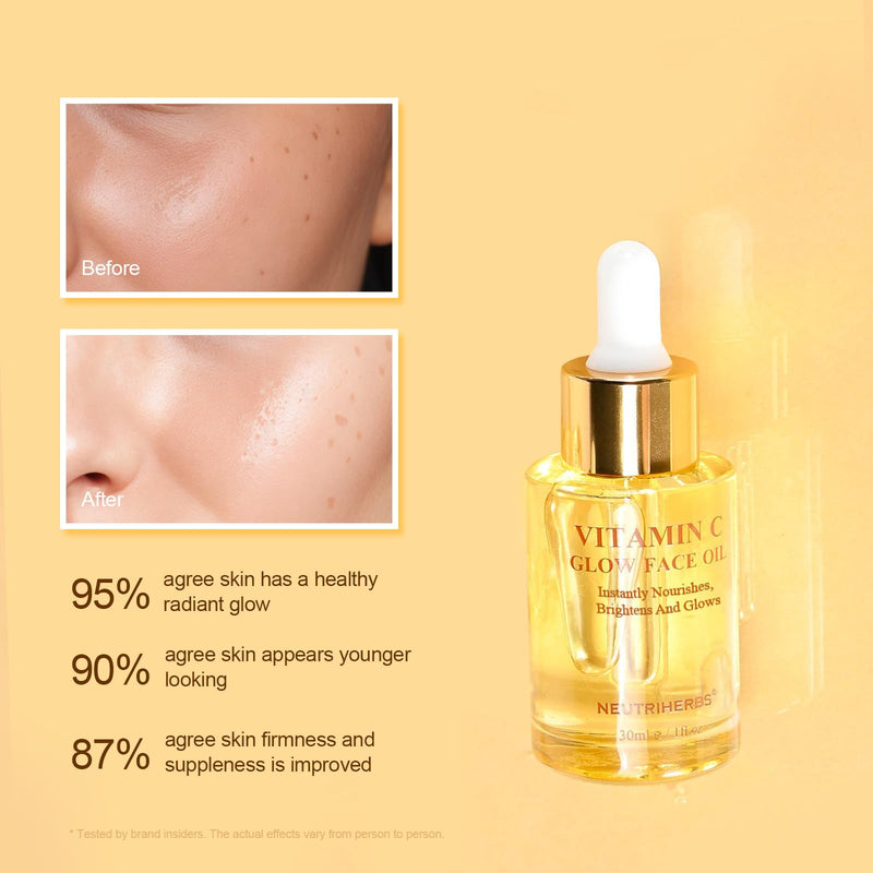 Neutriherbs Rosehip Seed Face Oil with Vitamin C Nourish Dry Skin - 1fl Oz | Enriched Jojoba, Grape Seed Oil, Lightweight Fast-Absorb Facial Oil, Hydrate, Brighten, Smooth Skin, Repair Skin Barrier