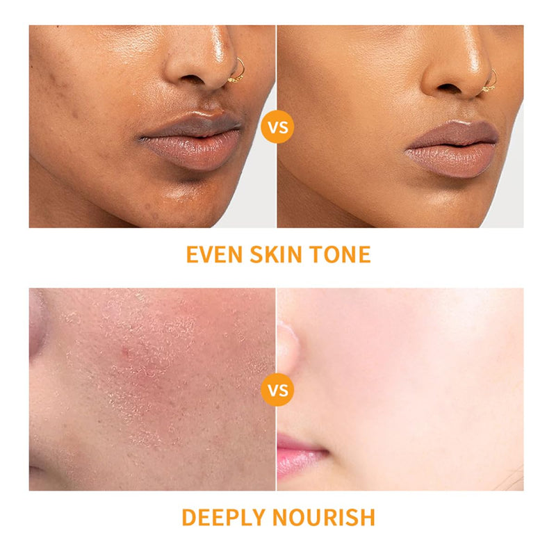 Baorder 6PCS Hydrating Skin Care Set with Vitamin C,Face Care Kit Includes Serum,Face Cream,Eye Cream,Toner,Sunscreen,Cleanser,Face Care Set for Women,Unique Gift