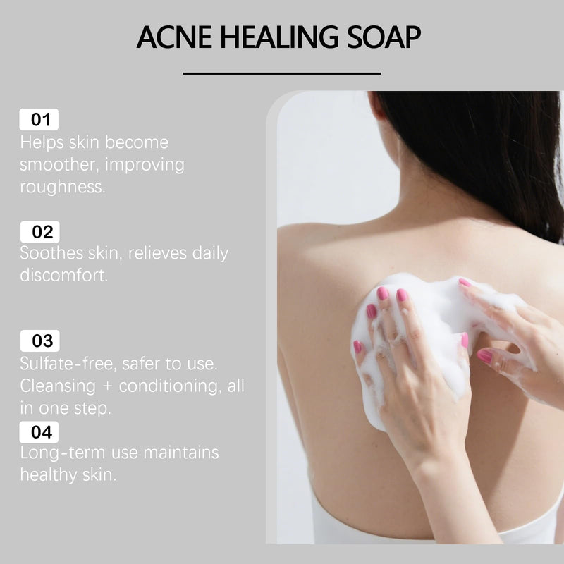 2 PCS Bacne Out Back Acne Cleansing Soap | Turmeric, Vitamin C & Alpha Arbutin Formula, Natural Exfoliating Cleanser For Back & Body Breakout Care