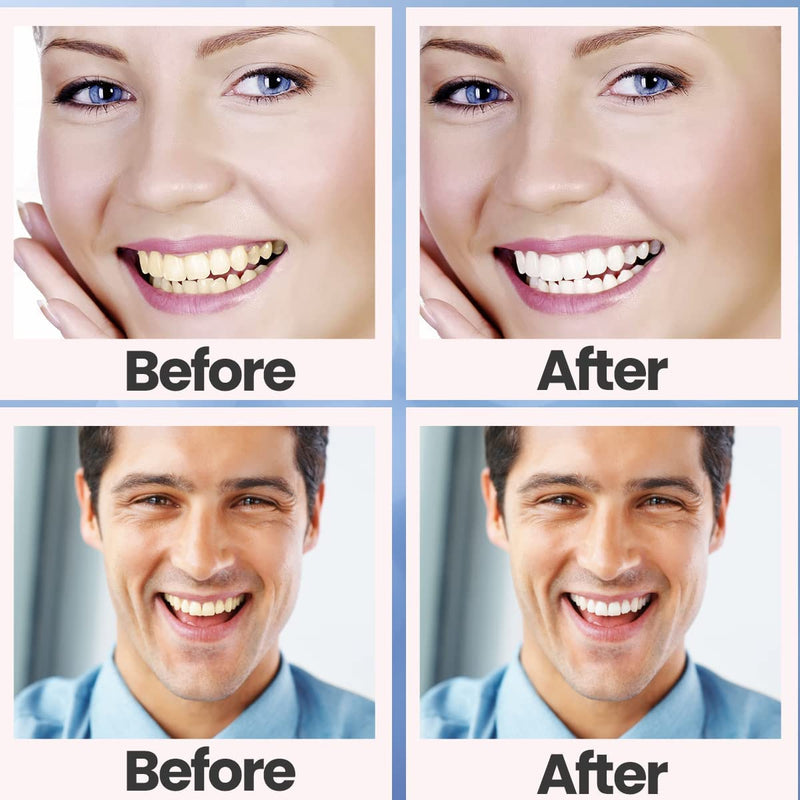 [Australia] - Teeth Whitening Strips, 28 Pcs Whitening Strips for Teeth Sensitive, Effective and Safe Whiting Stripes Reduced Sensitivity White-Strips, Helps Remove Smoking/Coffee/Soda/Wine Stain (14 Treatments) 