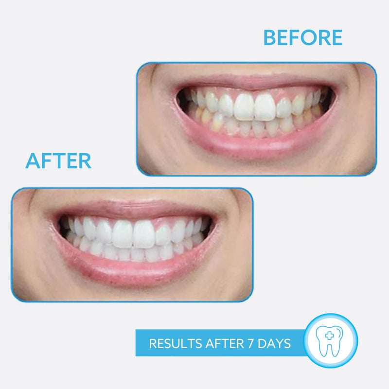 GO SMILE Professional Clean Luxury Whitening Toothpaste, large 3.4oz tube, Enriched with Vitamins A, C & E, Mint Flavor eliminates bad breath, Removes Stains, Dentist Recommended, Made in the USA 3.4 Ounce (Pack of 1)
