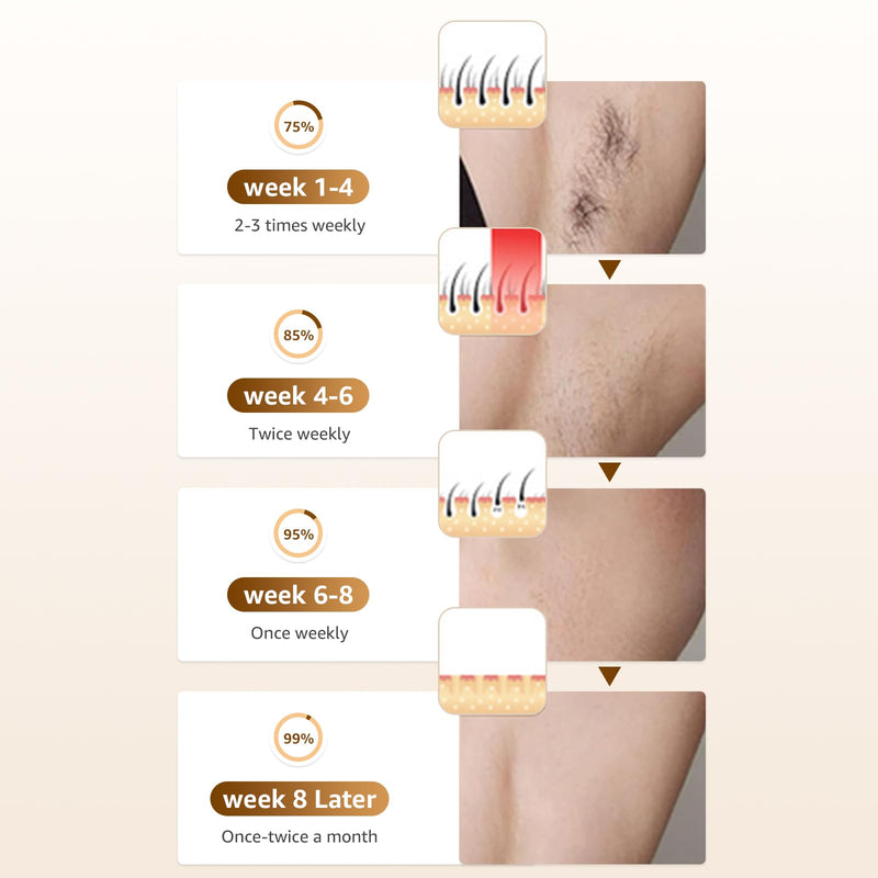 [Australia] - Ipl Laser Hair Removal ，Hair Removal Device with Painless Care Function for Women ，IPL Hair Remover for Facial Armpits Legs Arms Bikini Line (Purple) (White) White 