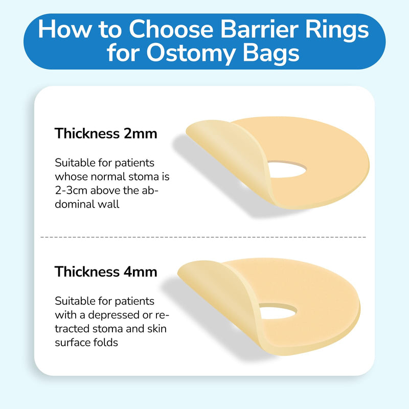[Australia] - 10PCS Ostomy Barrier Rings, Ostomy Supplies, 2mm Thickness Moldable Ostomy Rings Medical Grade Hydrocolloid Adhesive Barrier Rings Better Seal for Ostomy Bags (Box of 10) 2mm Ostomy Barrier Rings 