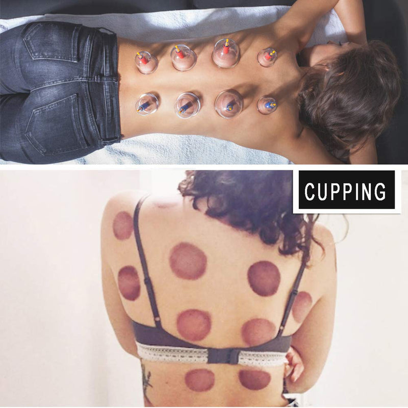 [Australia] - Cupping Set Professional Chinese Acupoint Cupping Therapy Sets Portable, Suction Hijama Cupping Set with Vacuum Magnetic Pump Cellulite Cupping Massage Kit 22-Cup 