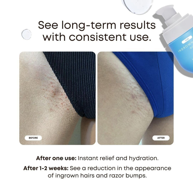 [Australia] - Bushbalm Ingrown Hair Oil - Helps Prevent and Repair Skin from Ingrown Hairs, Razor Burn & Underarm Bumps - Soothe Skin from Post Shave Itchiness, Irritation and Redness, 30 ml - Nude Oil 