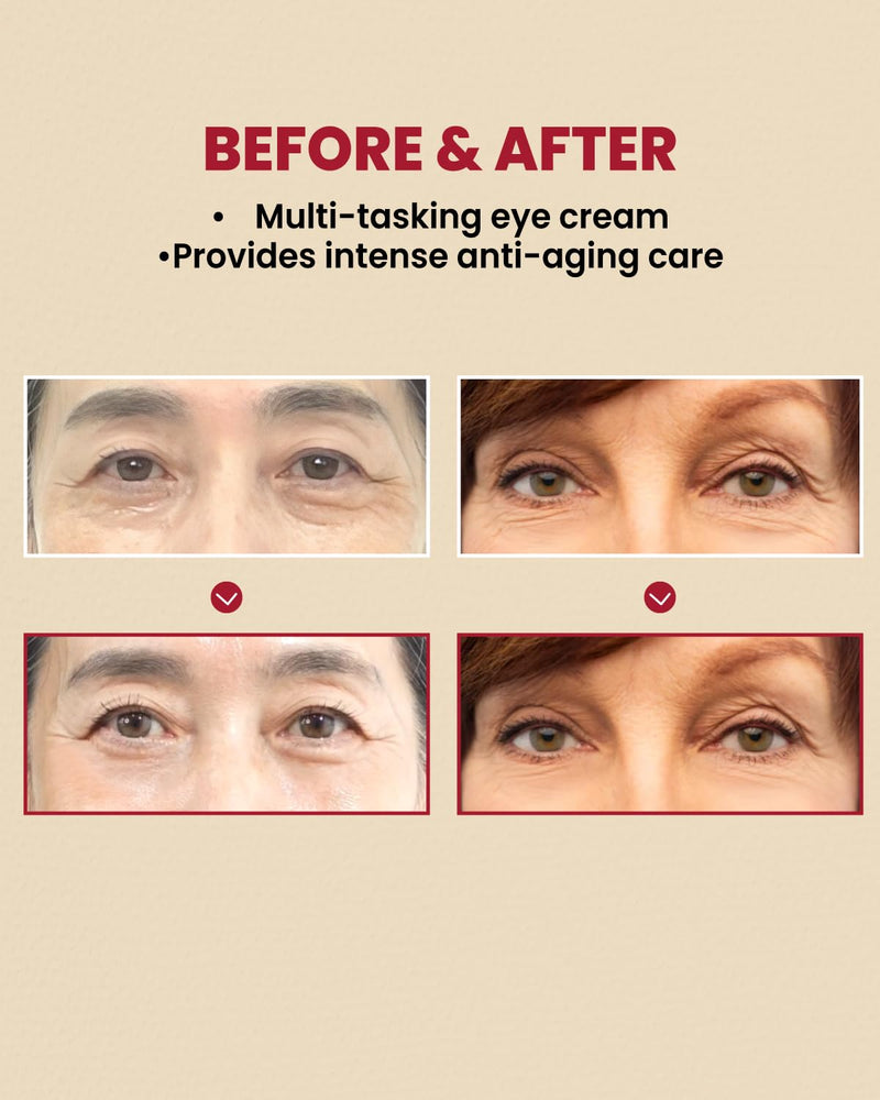 [Australia] - KSECRET SEOUL 1988 Eye Cream : Retinal Liposome 4% + Fermented Bean, wrinkle care, anti-aging, skin elasticity, pigmentation, retinol, 30ml/1.01 fl.oz. 