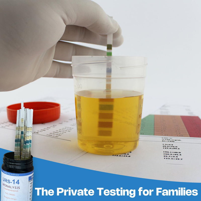 [Australia] - 14-Panels Urinalysis Test Strips | 120 Strips, Urinalysis and Detection for Kidney, Liver, UTI, Ketosis - SG, PRO, BIL, KET, CRT +9 More 