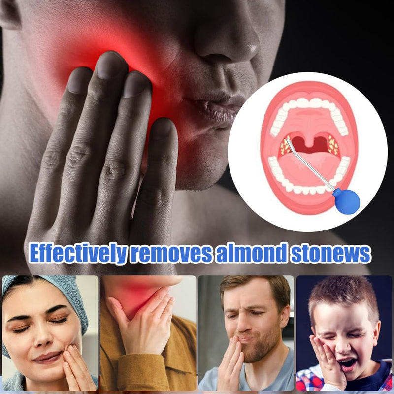 [Australia] - Riisoyu Tonsil Stone Removal Tool, Tonsilclin Tonsil Stone Cupping Glass with Suction Pipette Cupping Head Dental Mirror Tonsil Stone Remover for Bad Breath Oral Care Fresh Breath 