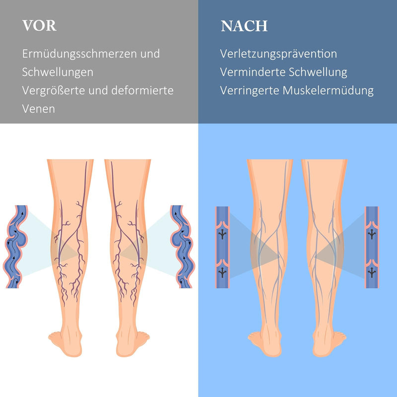 [Australia] - ZFSOCK Compression Stockings Thick Calf Support Stockings: Medical Compression Socks Zipper Sports Women Plus Size Open Toes Men Varicose Veins Thrombosis Stockings 1 Pair 20-30mmHg L-XL Beige-1 Pair 