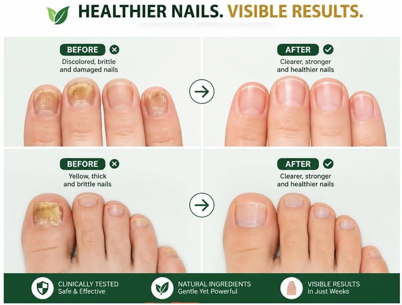 Nail Treatment | Tratamiento para uñas | 0.5oz | Made in USA (1 Pack) 1 Pack