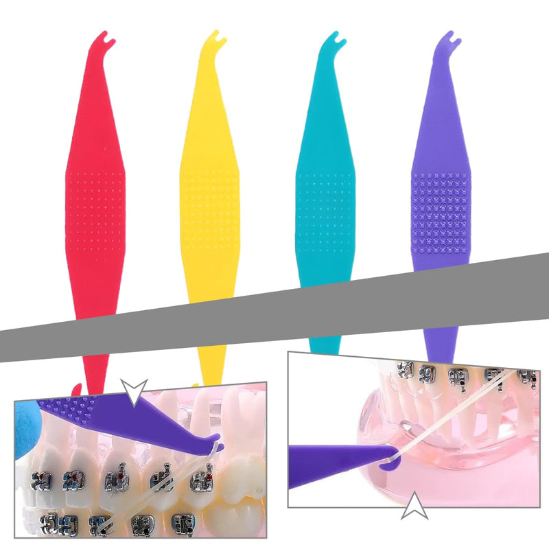 [Australia] - WeddHuis 8pcs Orthodontic Elastic Disposable Plastic Braces Braces Material Placement Removal Tools Elastic Rope Hook 