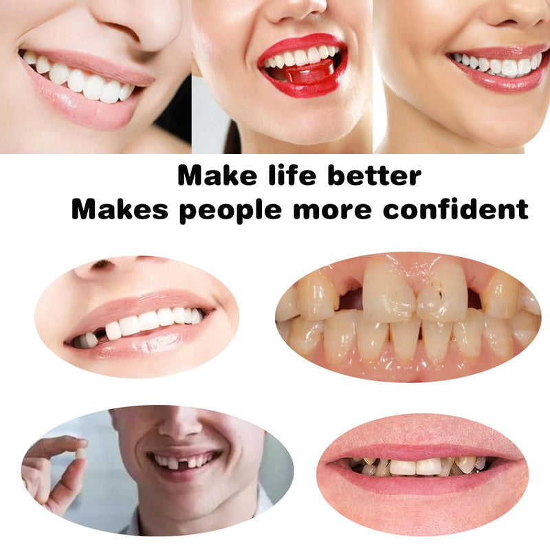 [Australia] - Tooth Repair Kit-Thermal Fitting Beads Granules and Fake Teeth for Temporary Fixing Missing and Broken Tooth，Replace a Missing Tooth in Minutes for Women and Man (Natural Yellow) 