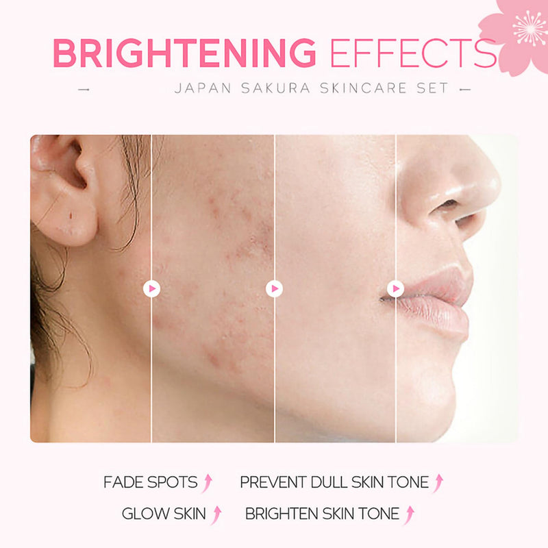 [Australia] - Skincare Gifts For Teenage Girls,Cherry Blossom Skincare Sets,Facial kit,Pamper Sets For Women Gifts,Skin Care Sets & Kits (SetA) 