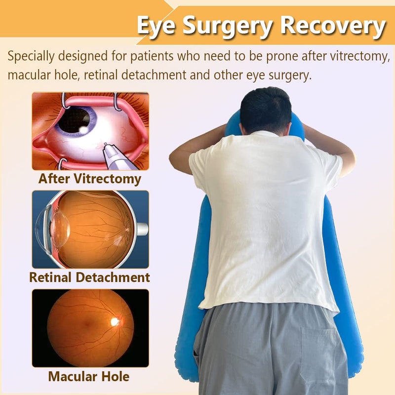 [Australia] - Face Down Pillow After Eye Surgery Prone Donut Pillow for Head Sleeping on Stomach Retinal Detachment Vitrectomy Recovery Equipment Face Support Breathe Easy Prone Cushion Pillow (Blue) Blue 