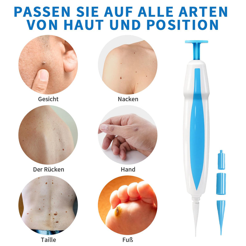 [Australia] - Wart remover, skin tag remover kit 2 in 1 for micro to large (2 mm-8 mm), safe and painless, pain-free stalk wart removal device, safe for most body parts 
