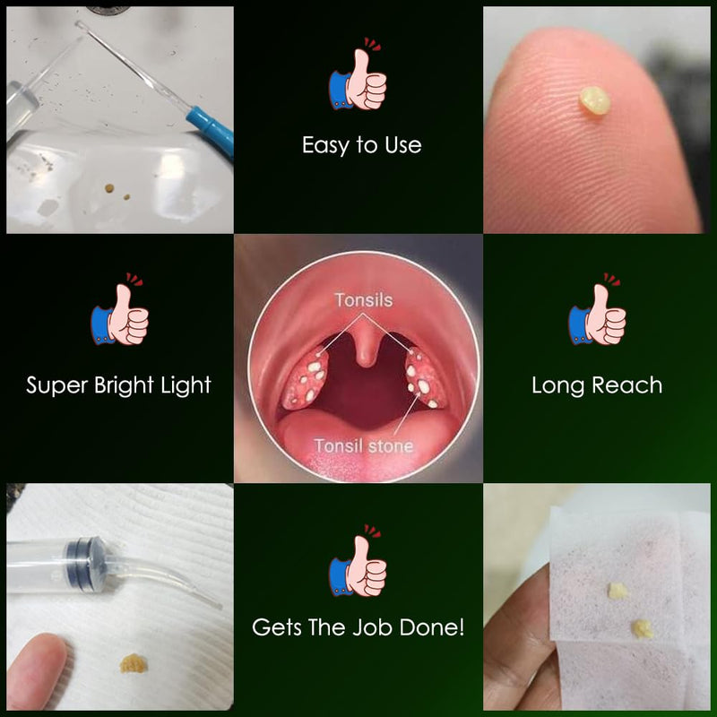 [Australia] - Airgoesin™ Upgraded Tonsil Stone Remover Tool, Blue, 5 Tips, Tonsillolith Pick Case + 1 Irrigator Fresh Breath Oral Rinse 