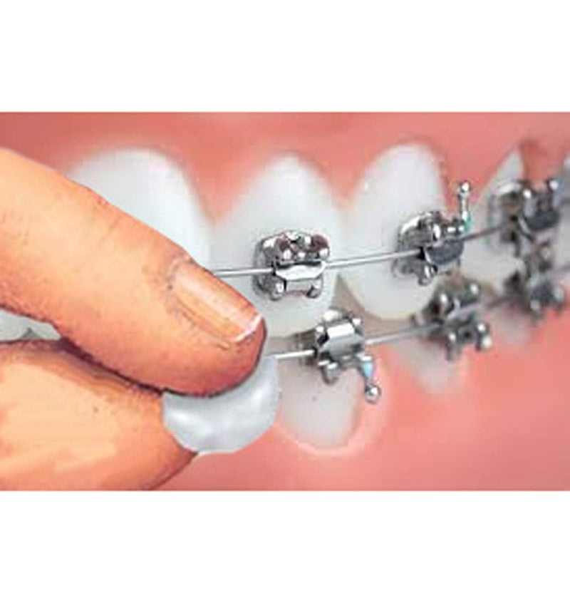 Genuine Orthowax - Orthodontic Wax for Braces Wearer - Stick Better Than competitors 9