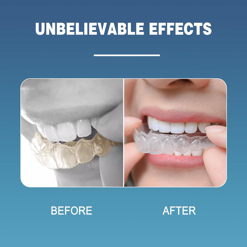 [Australia] - EZGO Retainer Cleaner Tablets, Denture Cleaning Tablets for Mouth Guard, Night Guard and Removable Dental Appliances, Removes Stains, Bad Odor, Plaque in 3 Minutes, 4 Months Supply (120 pcs) 