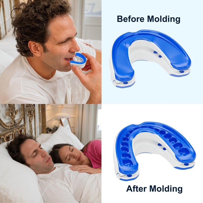 [Australia] - VitalSleep Anti-Snoring Mouthpiece + Cleaner, Men's Size – Adjustable, Custom-Fit Snoring Remedy – Comfortable Sleep Aid Mouthguard for Restful Nights – USA-Made, FDA-Cleared 